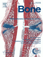 The effect of weight loading and subsequent release from loading on the postnatal skeleton