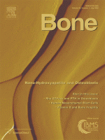 Determining the elastic modulus of mouse cortical bone using electronic speckle pattern interferometry (ESPI) and micro computed tomography: A new approach for characterizing small-bone material properties Determining the elastic modulus of mouse cortical bone using electronic speckle pattern interferometry (ESPI) and micro computed tomography: A new approach for characterizing small-bone material properties