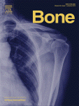 A temporary decrease in mineral density in perinatal mouse long bones