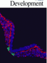HIF1? regulation of Sox9 in necessary to maintain differentiation of hypoxic prechondrogenic cells during early skeletogenesis HIF1? regulation of Sox9 in necessary to maintain differentiation of hypoxic prechondrogenic cells during early skeletogenesis