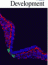 HIF1? regulation of Sox9 in necessary to maintain differentiation of hypoxic prechondrogenic cells during early skeletogenesis