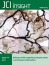 KrasP34R and KrasT58I mutations induce distinct RASopathy phenotypes in mice