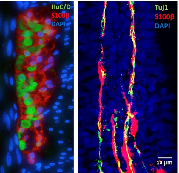 Myenteric ganglion_16W fetal villous