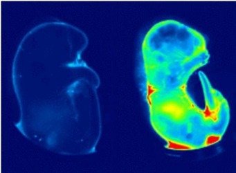 imaging_the_mouse_fetus_at_the_presence_or_absence_of_a_carrier_inhibitor_0.jpeg
