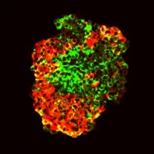 Using a stem cells to study human beta cell metabolism and function 2