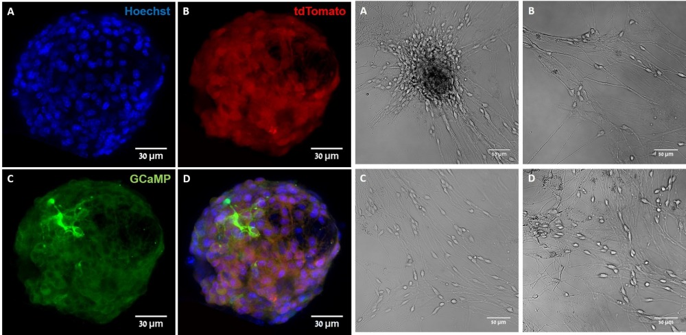 Neurospheres differentiation