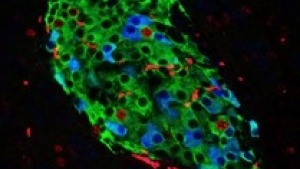 investigating_cellular_adaptation_to_nutritional_changes 3