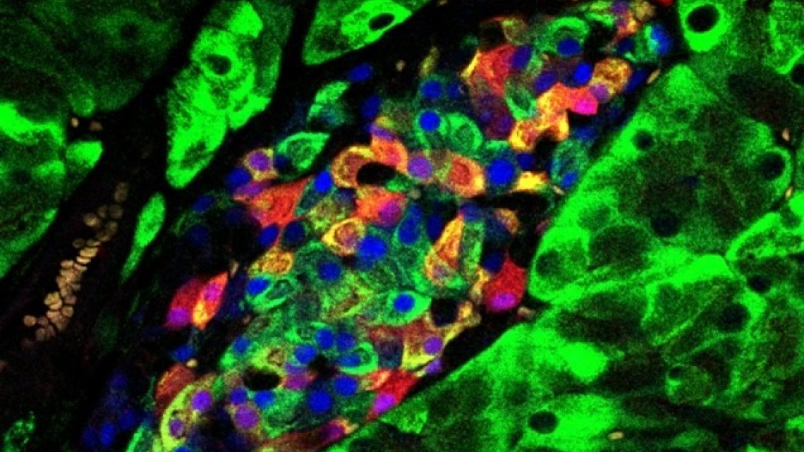 Investigating cellular adaptation to nutritional changes
