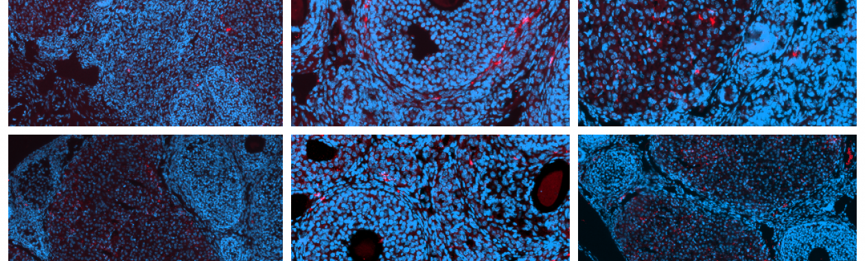 phage-1-injection-2